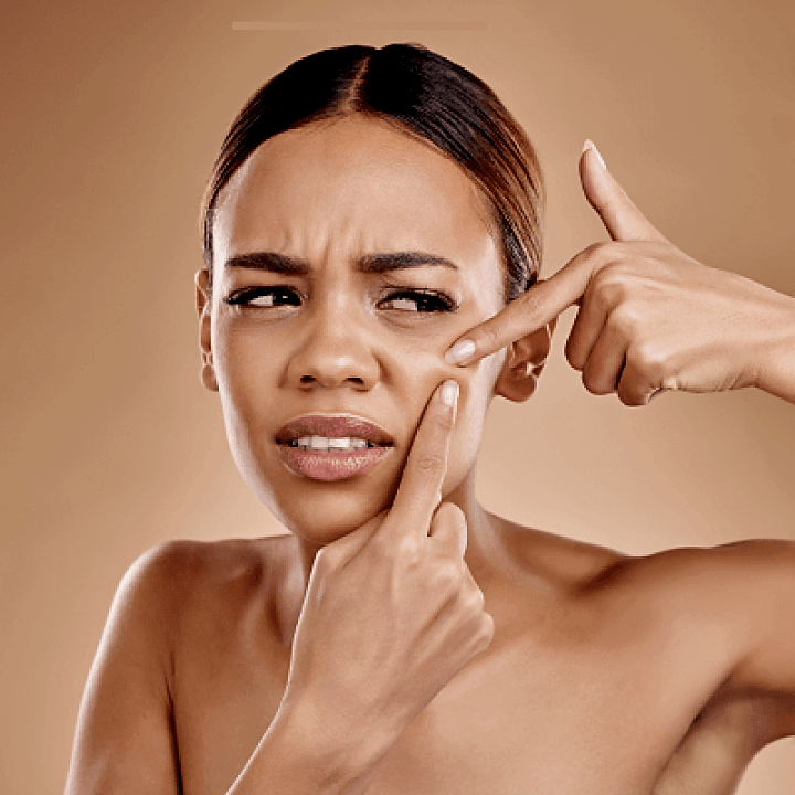 Komedon Nedir? Komedona Sebep Olan İçerikler Nelerdir?